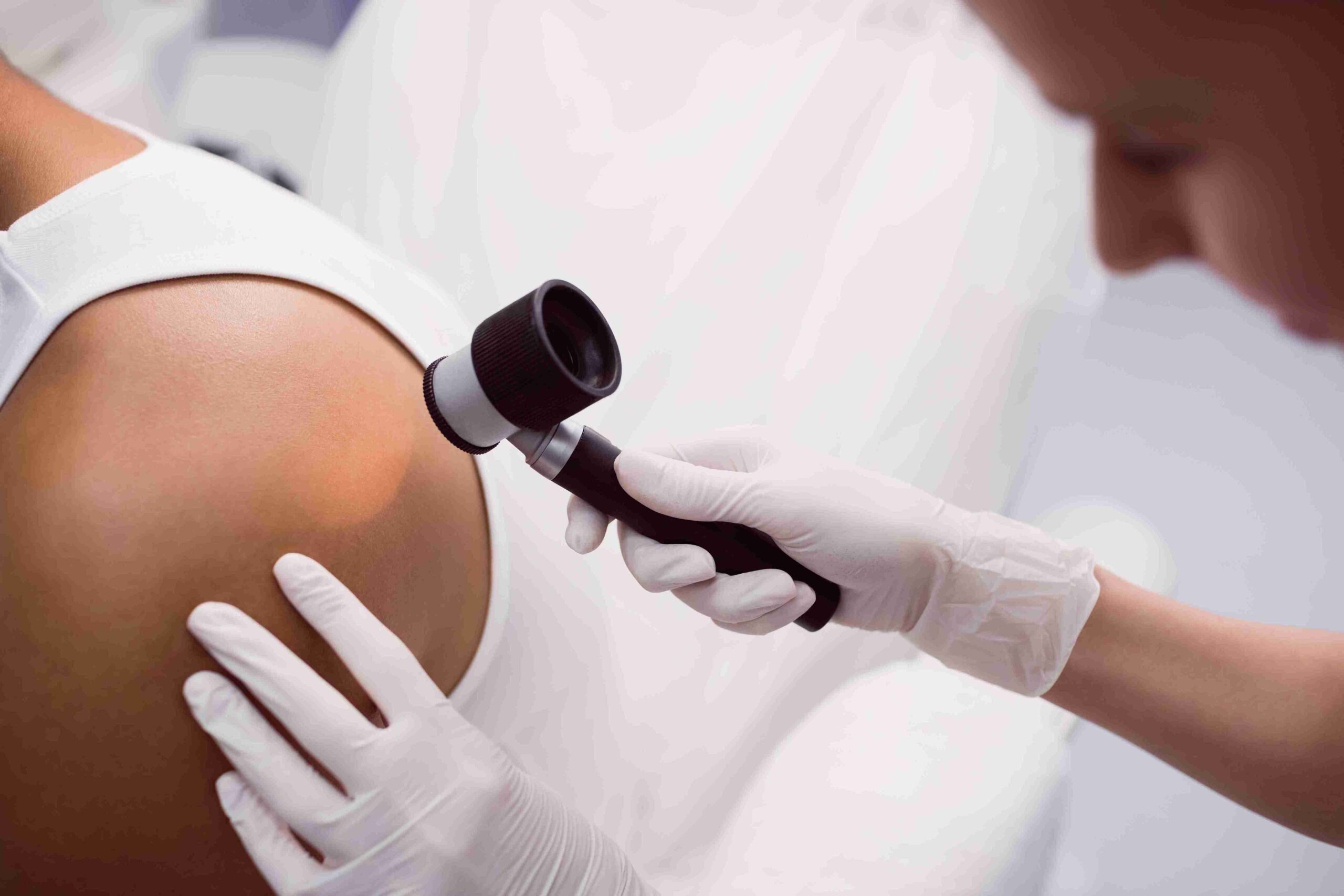 Dermatology