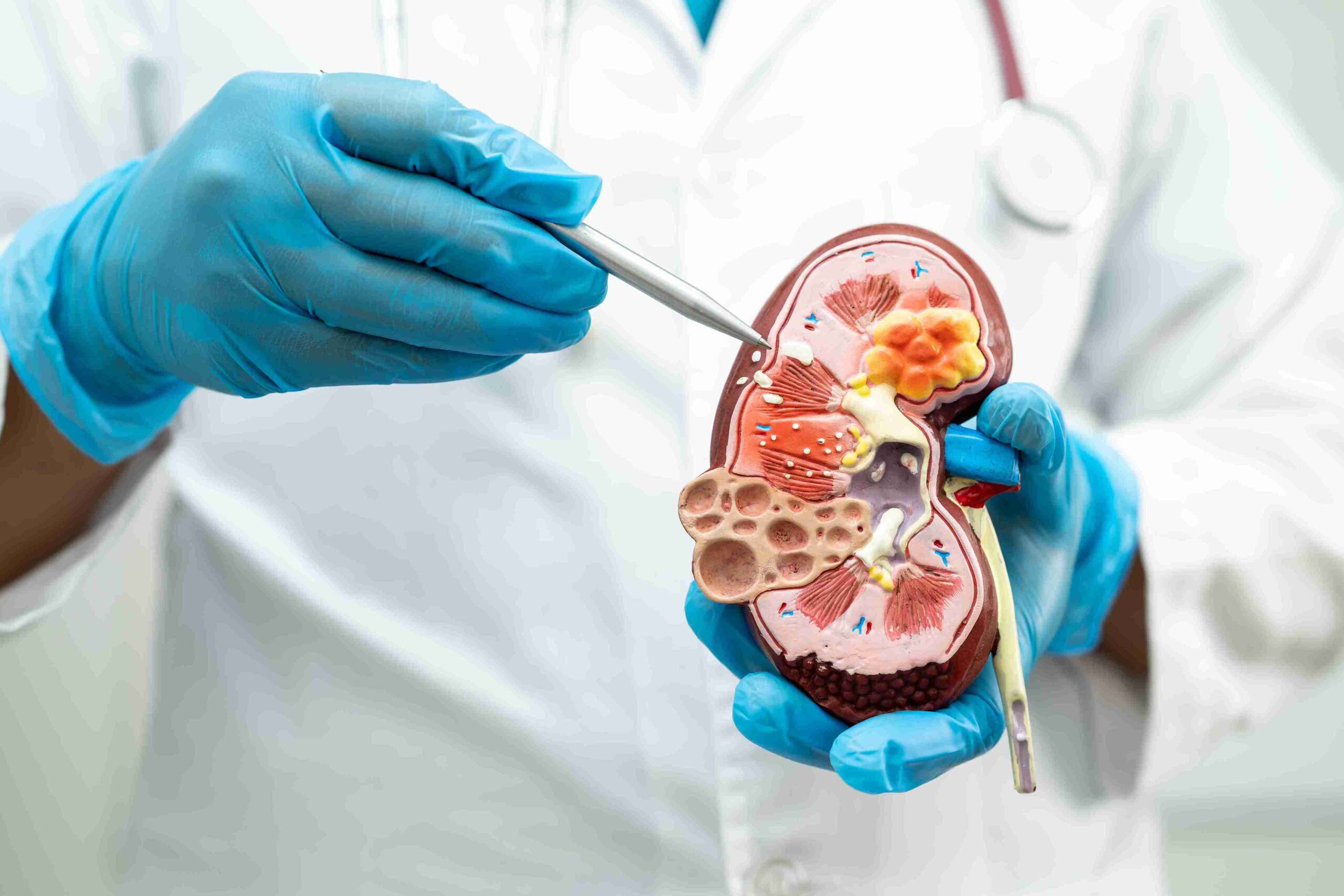 Nephrology